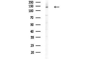 anti-HIV-1 Tat Specific Factor 1 (HTATSF1) (C-Term) antibody