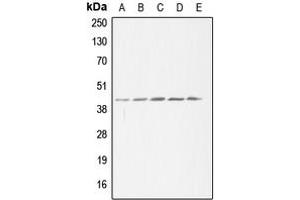 Western blot analysis of ACAT1 expression in HeLa (A), HEK293T (B), SP2/0 (C), H9C2 (D), THP1 (E) whole cell lysates. (ACAT1 Antikörper  (Center))