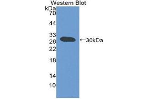 Western Blotting (WB) image for anti-ATP-Binding Cassette, Sub-Family B (MDR/TAP), Member 11 (ABCB11) (AA 420-656) antibody (ABIN1980368) (ABCB11 Antikörper  (AA 420-656))
