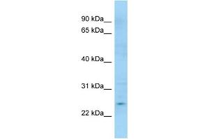 WB Suggested Anti-APOBEC3H Antibody Titration: 1. (APOBEC3H Antikörper  (C-Term))