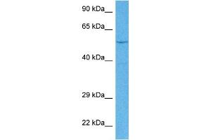 Host:  Rabbit  Target Name:  EYA1  Sample Tissue:  Human MCF7 Whole Cell  Antibody Dilution:  1ug/ml (EYA1 Antikörper  (Middle Region))