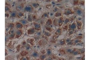 Immunohistochemistry (IHC) image for anti-Proteasome (Prosome, Macropain) 26S Subunit, Non-ATPase, 9 (PSMD9) (AA 2-223) antibody (ABIN7442213)