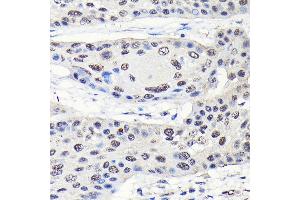Immunohistochemistry (IHC) image for anti-GTP Binding Protein 4 (GTPBP4) (AA 385-634) antibody (ABIN1680142)