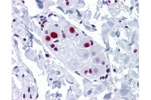 Anti-SNRPA antibody IHC of human small intestine, submucosal plexus. (SNRPA1 Antikörper  (AA 1-283))