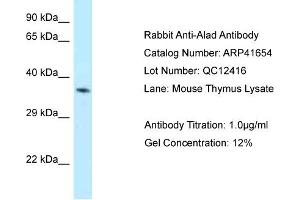 Host: Rabbit Target Name: ALAD Sample Tissue: Mouse Thymus Antibody Dilution: 1ug/ml