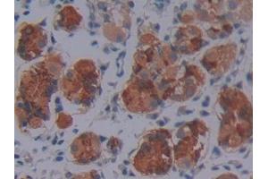 DAB staining on IHC-P; Samples: Human Stomach Tissue (SCO2 Antikörper  (AA 42-266))