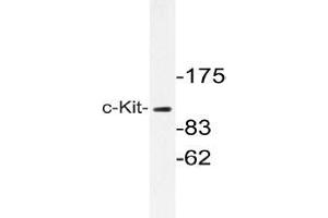 Western blot with extracts from A549 cells using c-Kit antibody . (KIT Antikörper)