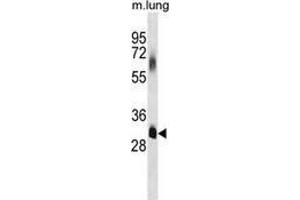 Western blot analysis in mouse lung tissue lysates (35ug/lane) using ELOVL7  Antibody (C-term).