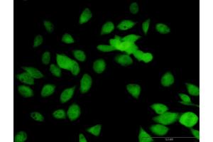 Immunofluorescence of purified MaxPab antibody to LOXL1 on HeLa cell. (LOXL1 Antikörper  (AA 1-574))