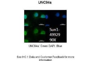 Immunohistochemistry (IHC) image for anti-Sad1 and UNC84 Domain Containing 1 (SUN1) (N-Term) antibody (ABIN2783971)