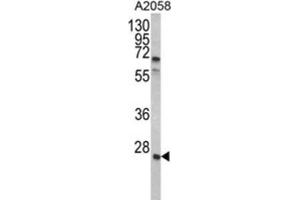 Western Blotting (WB) image for anti-Growth Factor Receptor-Bound Protein 2 (GRB2) antibody (ABIN3002593) (GRB2 Antikörper)