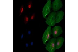 ABIN7094722 and ABIN7098773 staining  cells by IF/ICC. (SNRNP70 Antikörper  (Internal Region))