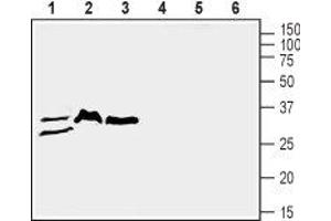 Western blot analysis of mouse lung (lanes 1 and 4), rat brain (lanes 2 and 5) and mouse brain (lanes 3 and 6) lysates: - 1-3. (SLC39A3 Antikörper  (1st Extracellular Loop))