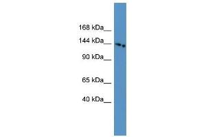 Western Blot showing SLC4A5 antibody used at a concentration of 1-2 ug/ml to detect its target protein.