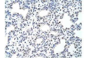 MCM6 antibody was used for immunohistochemistry at a concentration of 4-8 ug/ml to stain Alveolar cells (arrows) in Human Lung. (MCM6 Antikörper  (C-Term))