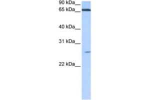 Western Blotting (WB) image for anti-Zinc Finger Protein 879 (ZNF879) antibody (ABIN2463464) (ZNF879 Antikörper)