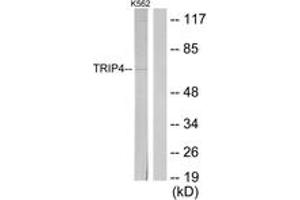 Western Blotting (WB) image for anti-Thyroid Hormone Receptor Interactor 4 (TRIP4) (AA 81-130) antibody (ABIN2889614) (TRIP4 Antikörper  (AA 81-130))