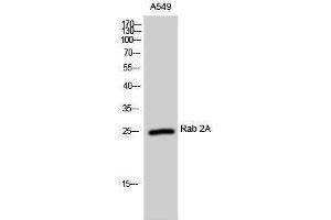 Western Blotting (WB) image for anti-RAB2A, Member RAS Oncogene Family (RAB2A) (Internal Region) antibody (ABIN3177066) (RAB2A Antikörper  (Internal Region))