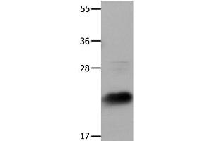 Western Blot analysis of Hela cells using IL18 Polyclonal Antibody at dilution of 1:1350 (IL-18 Antikörper)