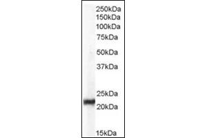 Image no. 2 for anti-Chromobox Homolog 5 (CBX5) (Internal Region) antibody (ABIN374617) (CBX5 Antikörper  (Internal Region))