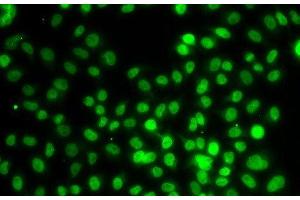 Immunofluorescence analysis of MCF-7 cells using SETD8 Polyclonal Antibody (SETD8 Antikörper)