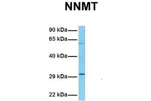 Host:  Rabbit  Target Name:  NNMT  Sample Tissue:  Human Hela  Antibody Dilution:  1. (NNMT Antikörper  (N-Term))