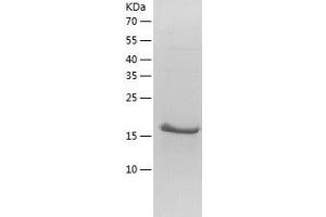 Western Blotting (WB) image for NFKB Inhibitor Interacting Ras-Like 1 (NKIRAS1) (AA 1-192) protein (His tag) (ABIN7124164) (NKIRAS1 Protein (AA 1-192) (His tag))