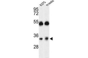 Western Blotting (WB) image for anti-ORAI Calcium Release-Activated Calcium Modulator 1 (ORAI1) antibody (ABIN3004147)