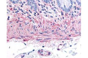 Immunohistochemical (Formalin/PFA-fixed paraffin-embedded sections) staining in human colon (smooth muscle) with TACR2 polyclonal antibody . (TACR2 Antikörper)