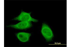 Immunofluorescence of purified MaxPab antibody to CAST on HeLa cell. (Calpastatin Antikörper  (AA 1-667))