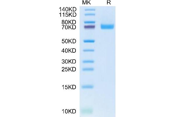 EPH Receptor B2 Protein (EPHB2) (AA 19-542) (His tag)