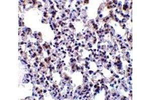 Immunohistochemistry (IHC) image for anti-B-Cell Receptor-Associated Protein 31 (BCAP31) (Middle Region) antibody (ABIN1030882) (BCAP31 Antikörper  (Middle Region))