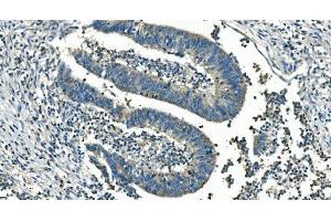 IHC analysis of IDH2 using anti-IDH2 antibody (ABIN7602786).