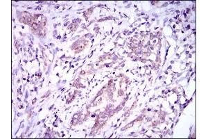 Immunohistochemistry (IHC) image for anti-Dynein, Axonemal, Light Chain 4 (DNAL4) (AA 1-105) antibody (ABIN1724810)