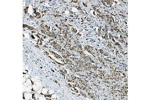 IHC analysis of RAB1B using anti-RAB1B antibody (ABIN7602809). (RAB1B Antikörper  (C-Term))