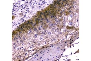 IHC analysis of TMEM16A using anti-TMEM16A antibody (ABIN6719430).