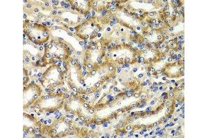 Immunohistochemistry of paraffin-embedded Mouse kidney using DGKE Polyclonal Antibody at dilution of 1:100 (40x lens).