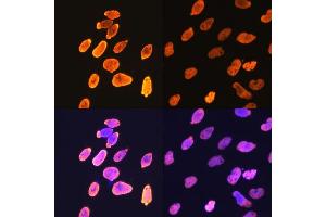 Immunofluorescence (IF) image for anti-Histone H4 (acLys5) antibody (ABIN7267743)