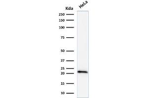 Western Blot Analysis of human HeLa cell lysate using p21 Mouse Monoclonal Antibody (DCS-60.