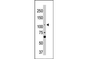 The LATS2 polyclonal antibody  is used in Western blot to detect LATS2 in NIH/3T3 cell lysate . (LATS2 Antikörper  (AA 195-224))