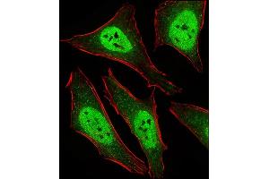 Fluorescent ige of Hela cells stained with D2L2 Antibody (C-term) (ABIN6243877 and ABIN6577436). (MAD2L2 Antikörper  (C-Term))