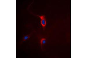Immunofluorescent analysis of mGLUR4 staining in HeLa cells. (Metabotropic Glutamate Receptor 4 Antikörper  (C-Term))