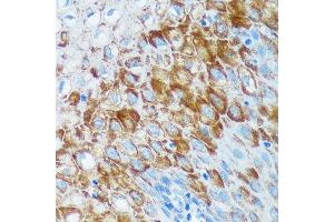 Immunohistochemistry of paraffin-embedded Human esophageal using IER5 Rabbit pAb (ABIN7267843) at dilution of 1:100 (40x lens). (IER5 Antikörper)