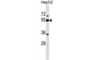 Western Blotting (WB) image for anti-Peptidase Inhibitor 16 (PI16) antibody (ABIN2999664) (PI16 Antikörper)