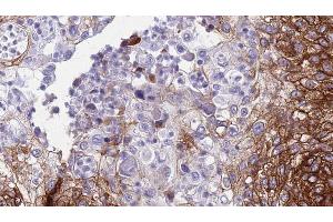 Immunohistochemistry (IHC) image for anti-Cadherin 9 (CDH9) (Internal Region) antibody (ABIN6257693)