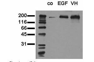 Phosphospecificity: Whole cell extracts of control (co), EGF stimulated (EGF) or pervanadate treated (VH) A549 tumor cells were applied to SDS-PAGE (20,000 cells per lane) and transferred to a PVDF membrane. (EGFR Antikörper  (pTyr1173))