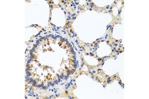 Immunohistochemistry of paraffin-embedded rat lung using LRG1 antibody. (LRG1 Antikörper)