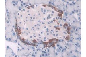 Detection of UCP1 in Rat Pancreas Tissue using Polyclonal Antibody to Uncoupling Protein 1, Mitochondrial (UCP1) (UCP1 Antikörper  (AA 179-296))
