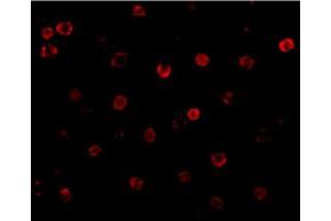 Immunofluorescence of CDH13 in K-562 cells with CDH13 polyclonal antibody  at 20 ug/mL . (Cadherin 13 Antikörper  (N-Term))
