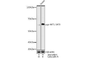 Western blot analysis of extracts of Jurka cells, using Phospho--S473 antibody (ABIN3019619, ABIN3019620, ABIN3019621 and ABIN1681366) at 1:1000 dilution. (AKT1 Antikörper  (pSer473))